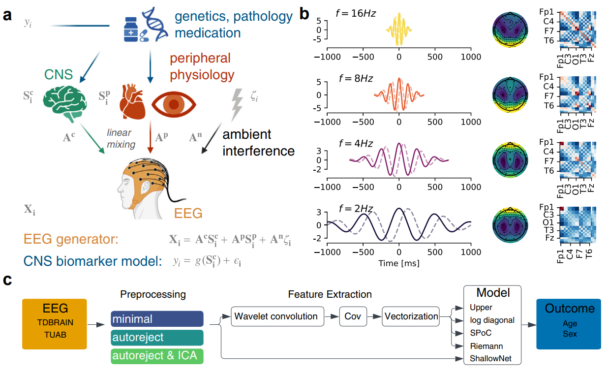 brain_eeg_biomarker.png
